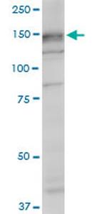 SRGAP1 Antibody in Western Blot (WB)