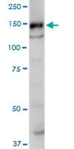 SRGAP1 Antibody in Western Blot (WB)