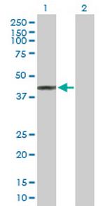 KIAA1456 Antibody in Western Blot (WB)