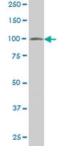 VPS18 Antibody in Western Blot (WB)