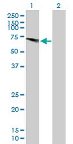 USP28 Antibody in Western Blot (WB)