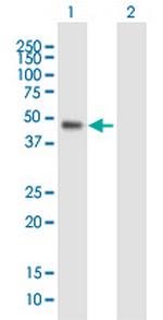 WDR19 Antibody in Western Blot (WB)