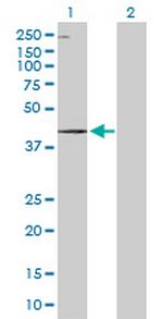 WDR19 Antibody in Western Blot (WB)