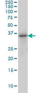 TRIB3 Antibody in Western Blot (WB)