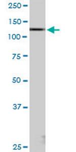 KIAA1967 Antibody in Western Blot (WB)