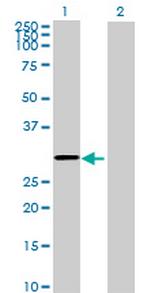 SRPRB Antibody in Western Blot (WB)