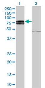 IL22RA1 Antibody in Western Blot (WB)