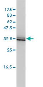 SIGIRR Antibody in Western Blot (WB)