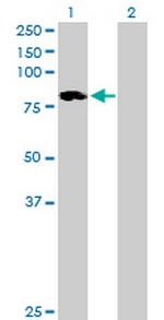 ALOXE3 Antibody in Western Blot (WB)