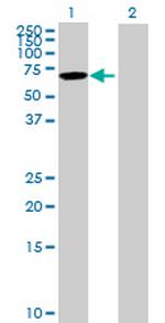 KLHL12 Antibody in Western Blot (WB)