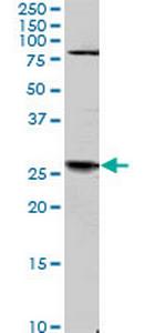 TGIF2 Antibody in Western Blot (WB)