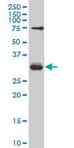 TGIF2 Antibody in Western Blot (WB)