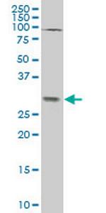 TGIF2 Antibody in Western Blot (WB)