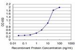 TGIF2 Antibody in ELISA (ELISA)