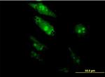 TGIF2 Antibody in Immunocytochemistry (ICC/IF)