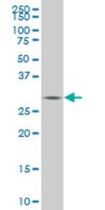 TGIF2 Antibody in Western Blot (WB)