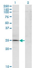 TGIF2 Antibody in Western Blot (WB)