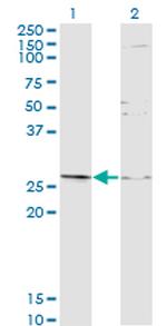 TGIF2 Antibody in Western Blot (WB)