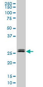 TGIF2 Antibody in Western Blot (WB)