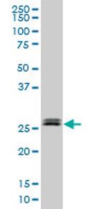 TGIF2 Antibody in Western Blot (WB)