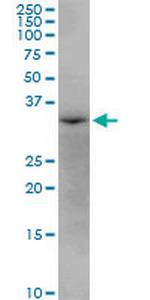 AASDHPPT Antibody in Western Blot (WB)