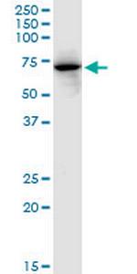 FKBP10 Antibody in Western Blot (WB)