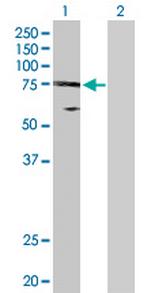 UBE2O Antibody in Western Blot (WB)