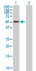 SH2D4A Antibody in Western Blot (WB)