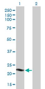 CIDEC Antibody in Western Blot (WB)