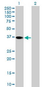 RBKS Antibody in Western Blot (WB)