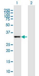 GOLPH3 Antibody in Western Blot (WB)