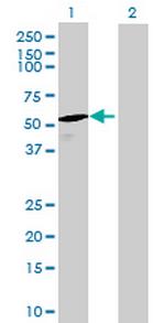 DUS1L Antibody in Western Blot (WB)