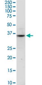 C17ORF75 Antibody in Western Blot (WB)