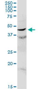 C17ORF75 Antibody in Western Blot (WB)