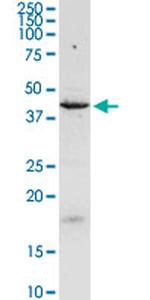 C17ORF75 Antibody in Western Blot (WB)