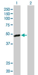 C17ORF75 Antibody in Western Blot (WB)