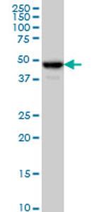 C17ORF75 Antibody in Western Blot (WB)