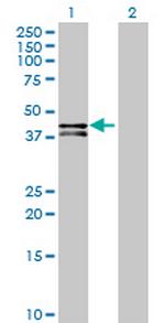 OSGEPL1 Antibody in Western Blot (WB)