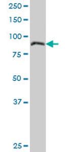 LEPRE1 Antibody in Western Blot (WB)