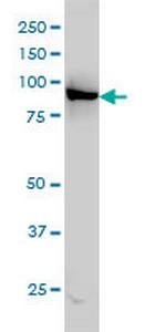 LEPRE1 Antibody in Western Blot (WB)