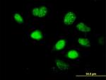 LHX5 Antibody in Immunocytochemistry (ICC/IF)