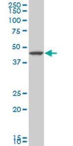 LHX5 Antibody in Western Blot (WB)