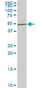 LHX5 Antibody in Western Blot (WB)