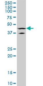 LHX5 Antibody in Western Blot (WB)