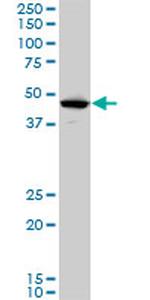 LHX5 Antibody in Western Blot (WB)