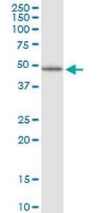 LHX5 Antibody in Western Blot (WB)