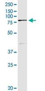 SEMA4A Antibody in Immunoprecipitation (IP)