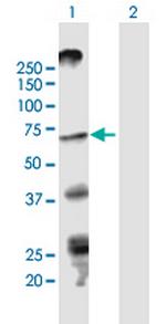 STRA6 Antibody in Western Blot (WB)