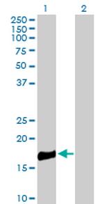 ROBO3 Antibody in Western Blot (WB)