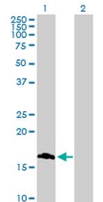 ROBO3 Antibody in Western Blot (WB)